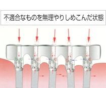 不適合なものを無理やりしめこんだ状態