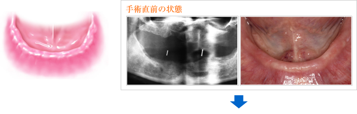 手術直前の状態
