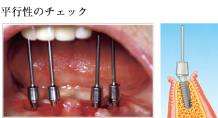 平行性のチェック