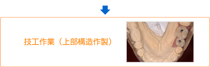 技工作業（上部構造作製）