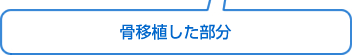 骨移植した部分