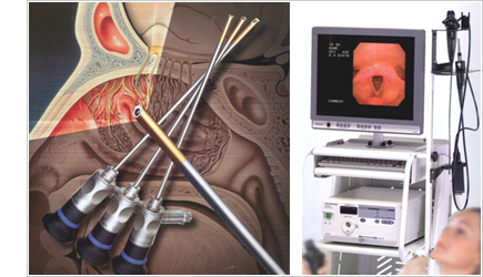インプラント手術における内視鏡の活用