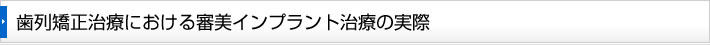 歯列矯正治療における審美インプラント治療の実際