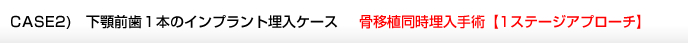 CASE2)　下顎前歯１本のインプラント埋入ケース　骨移植同時埋入手術【1ステージアプローチ】