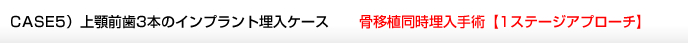CASE5）上顎前歯3本のインプラント埋入ケース　骨移植同時埋入手術【1ステージアプローチ】