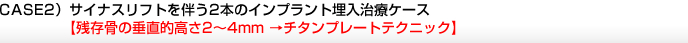 CASE2）サイナスリフトを伴う2本のインプラント埋入治療ケース 【残存骨の垂直的高さ2～4mm →チタンプレートテクニック】