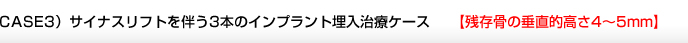 CASE3）サイナスリフトを伴う3本のインプラント埋入治療ケース 【残存骨の垂直的高さ4～5mm】