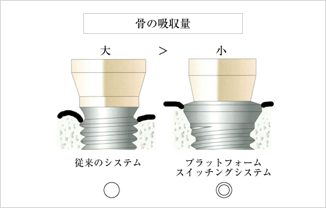 骨の吸収量 従来のシステム