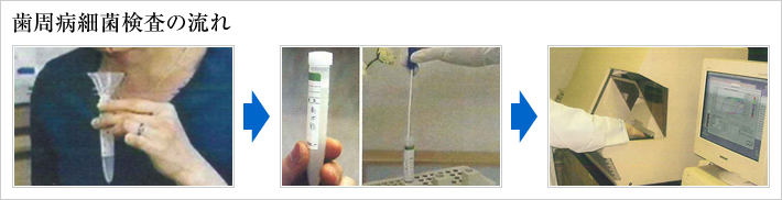 歯周病細菌検査の流れ