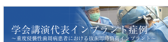 学会講演代表インプラント症例 ～重度慢性歯周病患者における抜歯即時負荷インプラント～